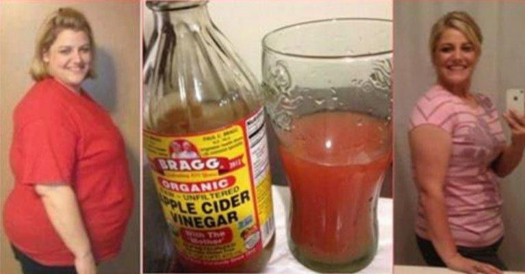 Apple Cider Vinegar Weight Loss Reviews
 How To Lose Stomach Fat Overnight literally with this so