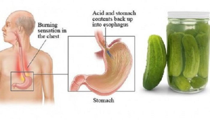 Benefits Of Drinking Pickle Juice
 Health Benefits of pickle juice