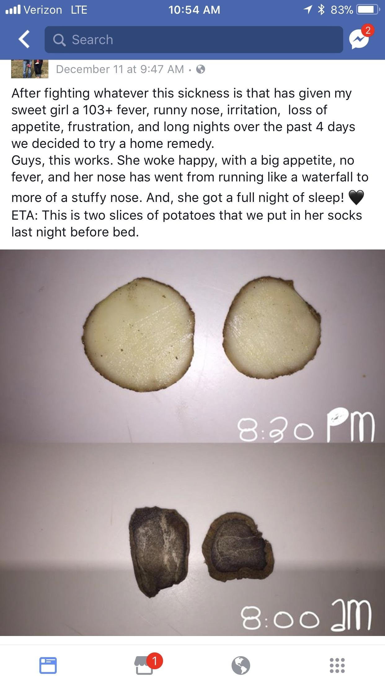 Potato On Feet
 The potatoes curing disease thing showed up in my news